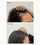 Sérum Rapunhair 70ml MONCHO MORENO